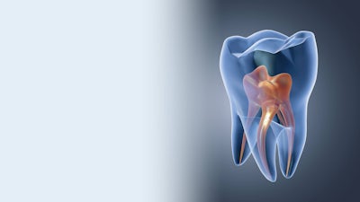 The Price of Root Canals