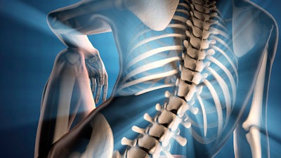 Michael Hane on Atlas Profilax