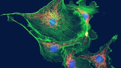 Theories and Treatments for Cancer with Travis Christofferson