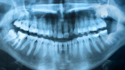 Alison Adams on Perils of Modern Dentistry