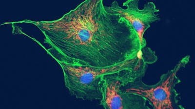 Theories and Treatments for Cancer with Travis Christofferson