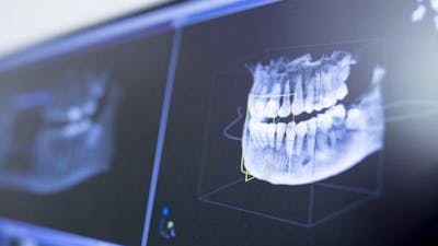 Biological Dentistry Breakthroughs