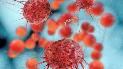 Cancer: Step Outside the Box with Ty Bollinger