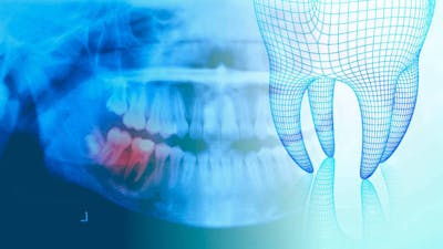 La médecine des dents