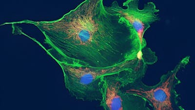 Teorías y tratamientos contra el cáncer, con Travis Christofferson