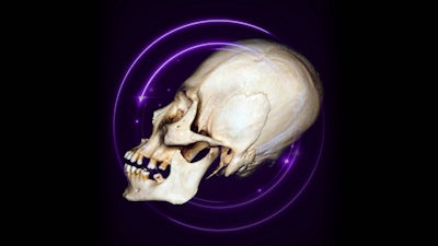 Cráneos alargados de nuestro mundo