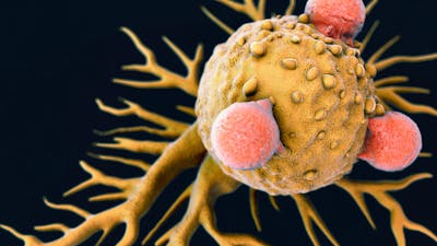 David Spiegel on the Cortisol Cancer link