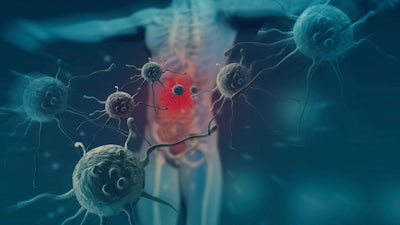 Body Ecology Diet with Donna Gates