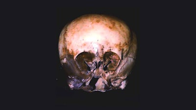 Resolving the Star Child Mystery with Chase Kloetzke & Kerry McClure