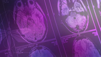 Neurosculpt Your Future