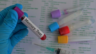 No Safe Level Of Mercury