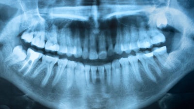 Alison Adams on Perils of Modern Dentistry