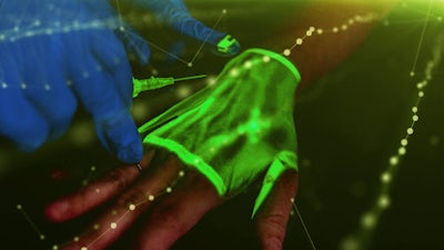 La nanotecnología de los implantes