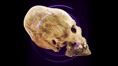 Los cráneos alargados de Paracas