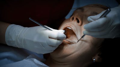 Mercury Exposure & Amalgam Removal