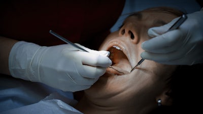 Mercury Exposure & Amalgam Removal