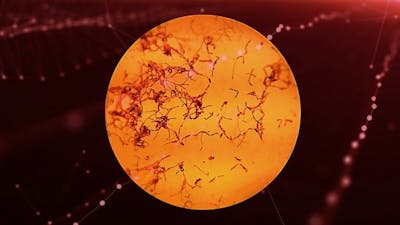 Is There life on Mars?