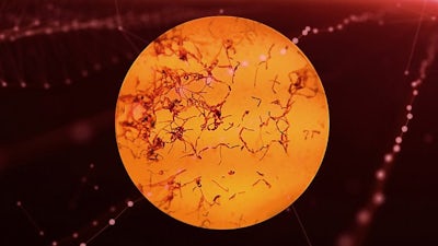 Is There life on Mars?