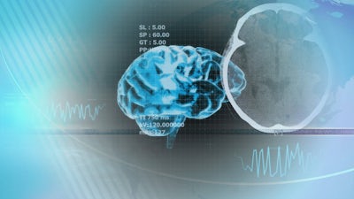 Alzheimers & Repetitive Negative Thinking